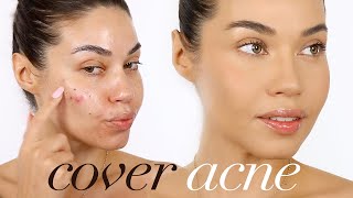 HOW TO COVER ACNE with MAKEUP | Eman