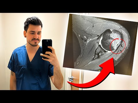 some not so great news...