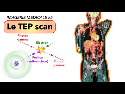 IMAGERIE MEDICALE #5 : Le TEP scan