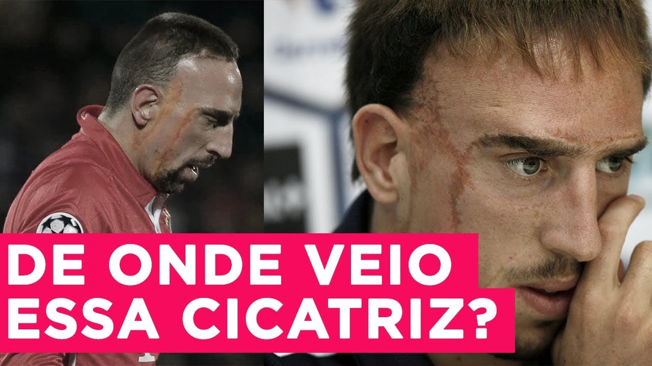 POR QUE RIBERY É TÃO RESPEITADO NO FUTEBOL ALEMÃO | #RadarPELEJA 19