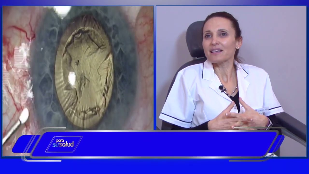 Watch ¿Se empaña el lente intraocular Dra Natalia Artal 22 01 2022 Now ¿Se empaña el lente intraocular Dra Natalia Artal 22 01 2022