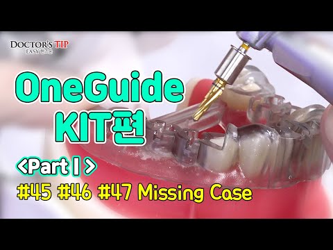 [OneGuide KIT PartⅠ] #45, #46, #47 Missing Case