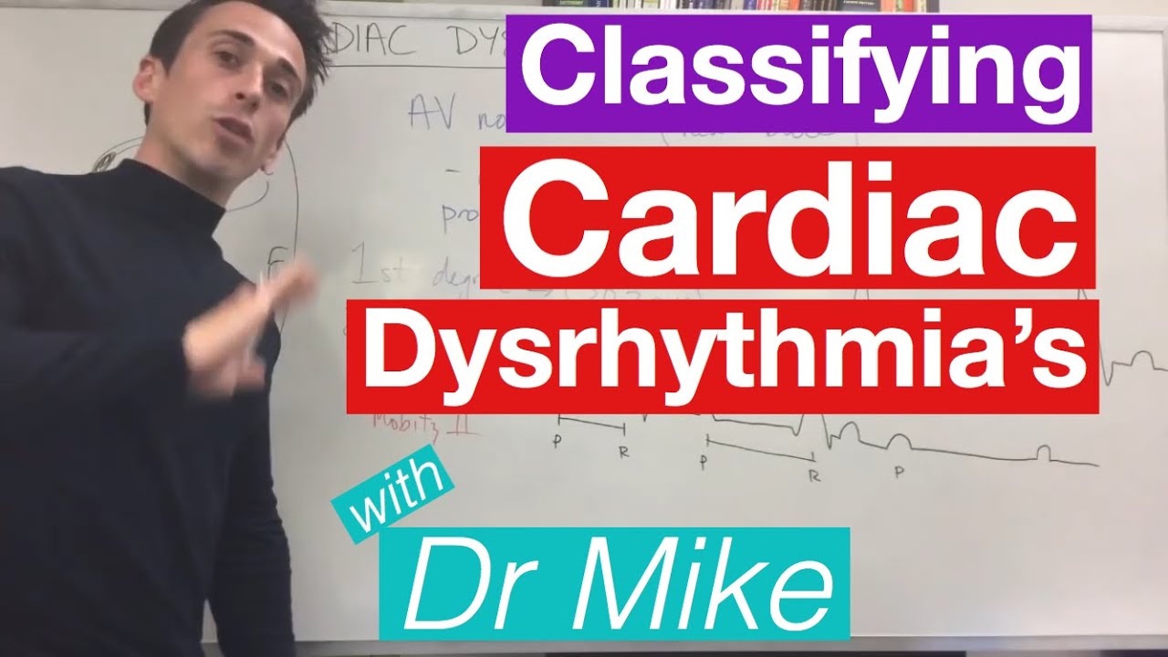 Cardiac dysrhythmias (arrhythmias) (common)