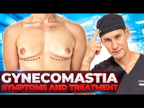 GYNECOMASTIA, Causes, Signs and Symptoms, Diagnosis and Treatment
