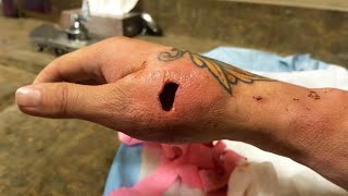 he has a hole in his hand..