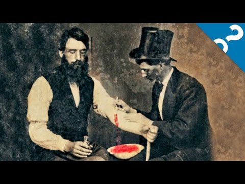 4 Things We Believed Before the Scientific Method | What the Stuff?!