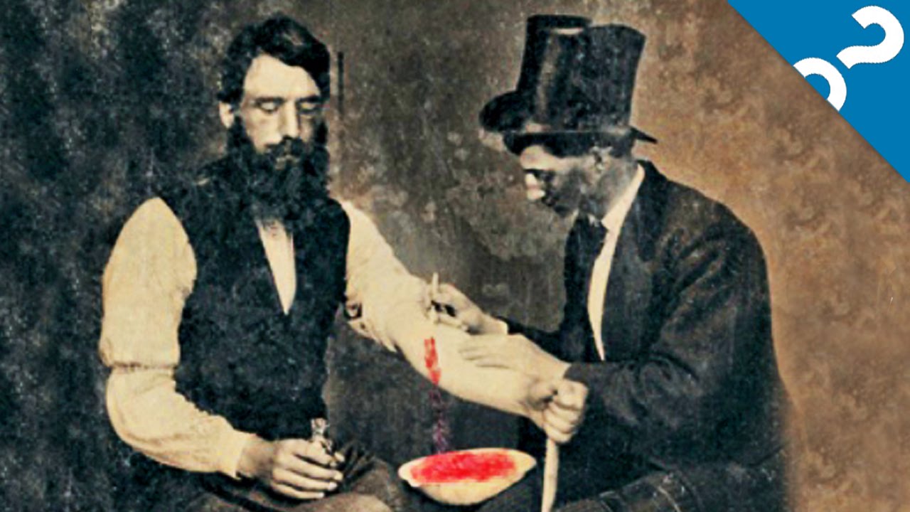 4 Things We Believed Before the Scientific Method | What the Stuff?!