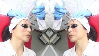 Clínica D´ Láser - Tratamiento para Melasma / Franco Villanueva