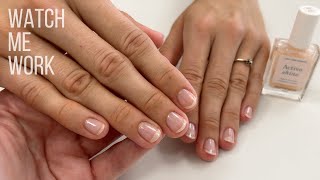 Problem nails with onycholysis Gentle Manicure with Manucurist Active Shine