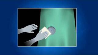 Coronary Artery Disease (Arteriosclerosis) Video Videos by St. Jude Medical - Heart Library.flv