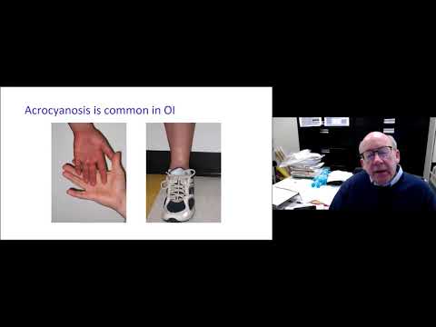 2020 Virtual Summer Conference: Fréquence Cardiaque élevée et Hypotension Artérielle by Dr. Peter Rowe | French (FR)