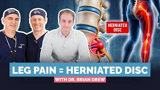 Sciatica And Leg PainnExplained By Spine Surgeon Dr Brian Drew