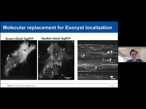 Yale Cancer Center Grand Rounds | April 20, 2021