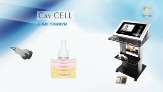 Cav cell - Top Quality Group - Microlipolisi Ultrasonica Trasdermica in Medicina Estetica