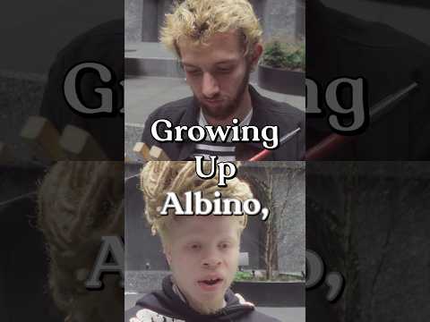 Growing up ALBINO #portrait #art #interview #drawing #albinism #albino #asmr