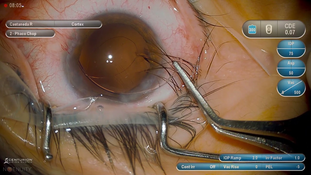 Rafael Castañeda Diez-21