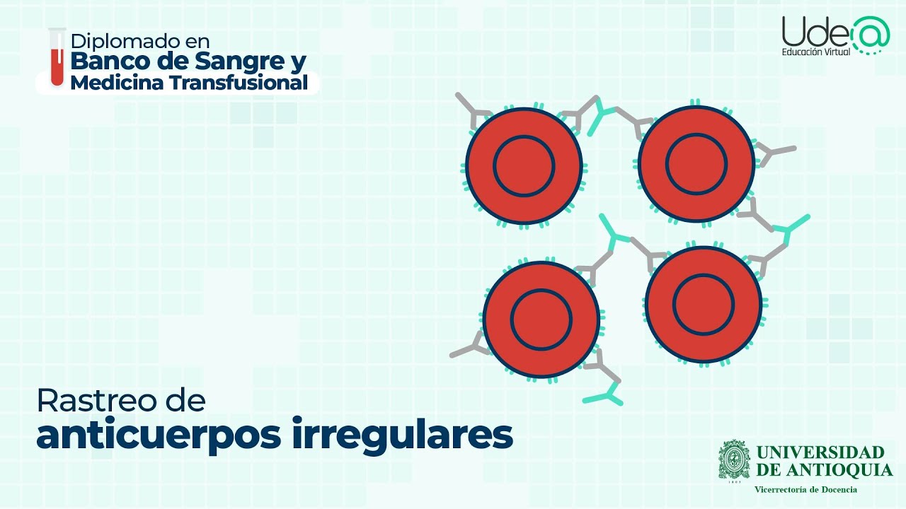 Rastreo de anticuerpos irregulares