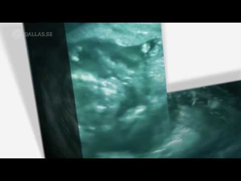 SVT Kunskapskanalen Channel ID "Ultrasound" - Dallas Sthlm