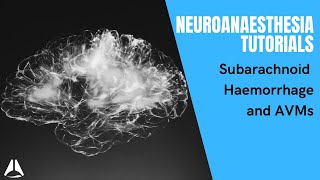 Neuro-anaesthesia tute part 1: Subarachnoid haemorrhage and AVM
