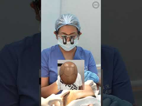 Amit Sen  -  India testimonial