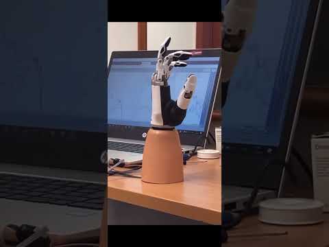 Pomôžme Michalovi získať bionickú protézu