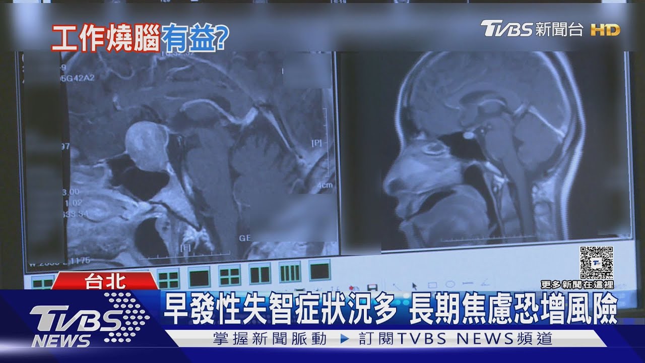 擺脫晚睡、紓解壓力 中年腦力打底避失智