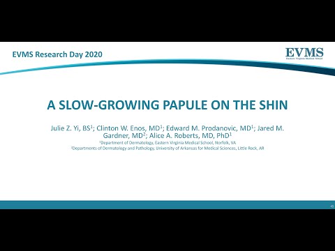 Thumbnail image of video presentation for A slow-growing papule on the shin