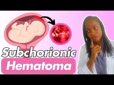 Bleeding in Early Pregnancy? Subchorionic Hemorrhage Explained