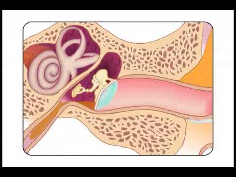 pourquoi il y a de la cire dans les oreilles