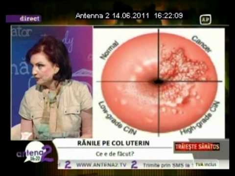 loc de frunze helminthosporium
