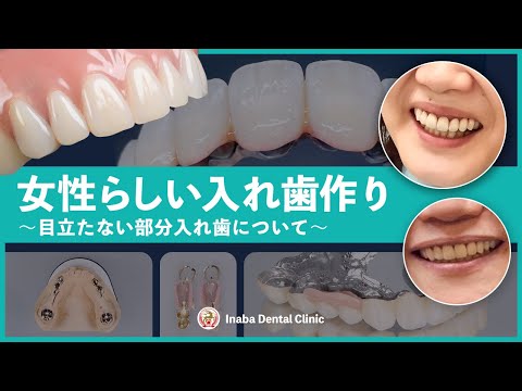 女性らしい入れ歯作り〜目立たない部分入れ歯について〜