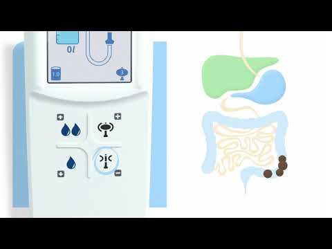 Navina Smart: Step-by-step