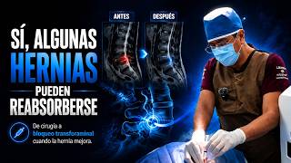  ¿Sabías que algunas hernias de disco pueden disminuir de tamaño con el tiempo?