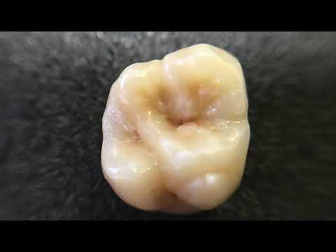 Prismatic Dentin