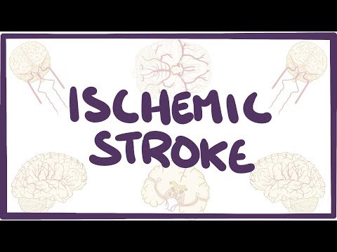 , title : 'Ischemic Stroke - causes, symptoms, diagnosis, treatment, pathology'