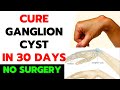 Best Of The Best Homeo Medicine For Ganglion Cyst