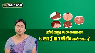 Doctor On Call 25-03-2023 PuthuYugam tv Show