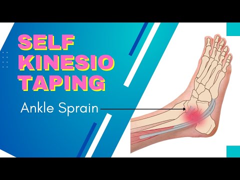 Sprained your ANKLE? - try this self kinesiology taping technique