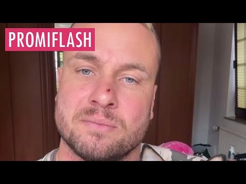 Hungerstreik Tag zwei: Eric Sindermann leidet Schmerzen