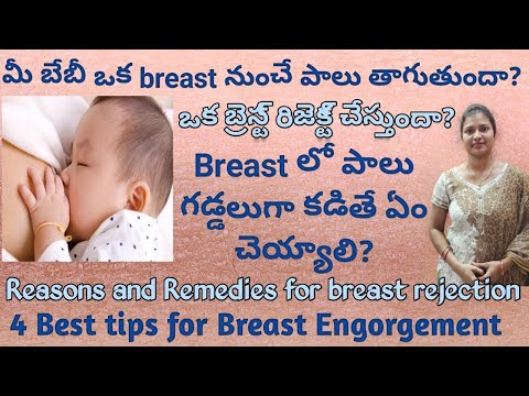 Why my baby rejecting one breast? || Tips for Breast Engorgement|| Breast lo milk gaddalu