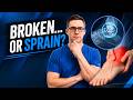 Don T Ignore These Symptoms Broken Foot Or Sprain