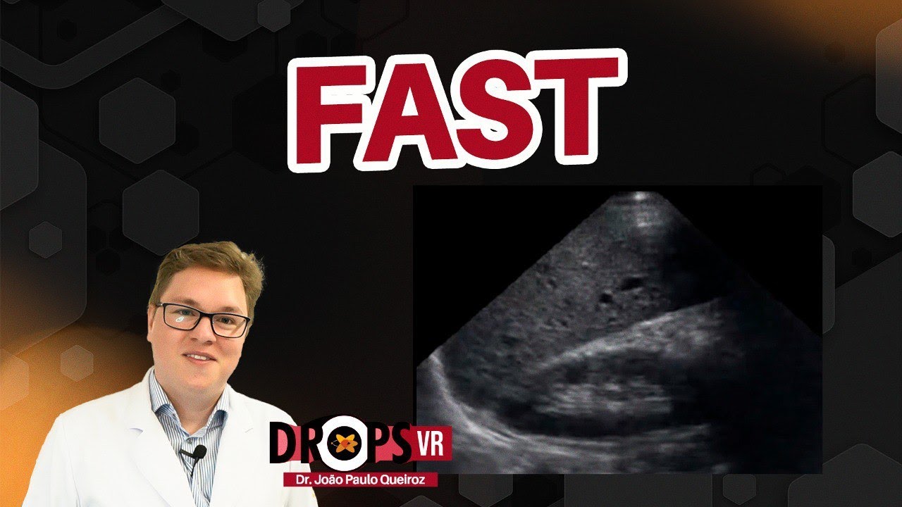 FAST (FOCUSED ASSESSMENT BY SONOGRAPHY IN TRAUMA) I VOCÊ RADIOLOGISTA