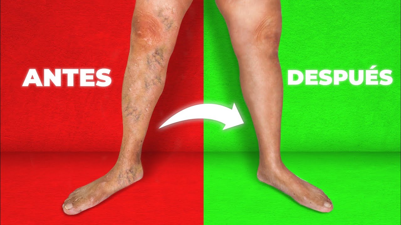 8 Formas Rápidas de Arreglar la Circulación de Piernas y Pies