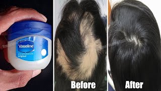 How To Grow Long Hair Fast-Super Fast Hair Growth Formula || Traditional Beauty Tips