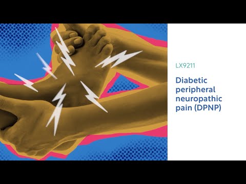 Have ongoing diabetic peripheral neuropathy with moderate to severe pain?