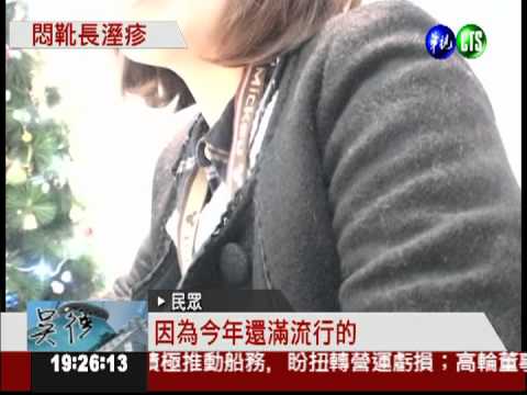 靴子穿太久! 腳趾頭紅腫長濕疹