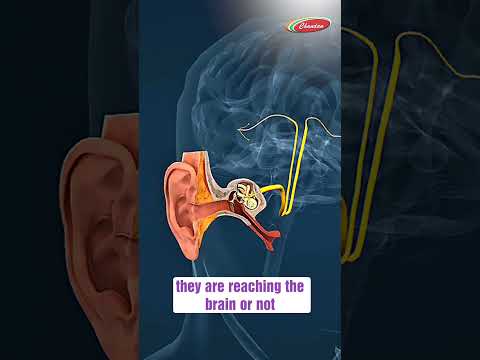 BERA Test Explained by Dr. Ranjan Kumar | Diagnose Hearing & Nerve Problems Early | Chandan Hospital