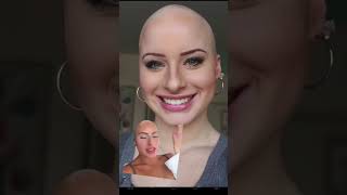 Download lagu The way my face & hair changed each year #hairloss #alopecia #bald #alopeciaawareness #viral mp3