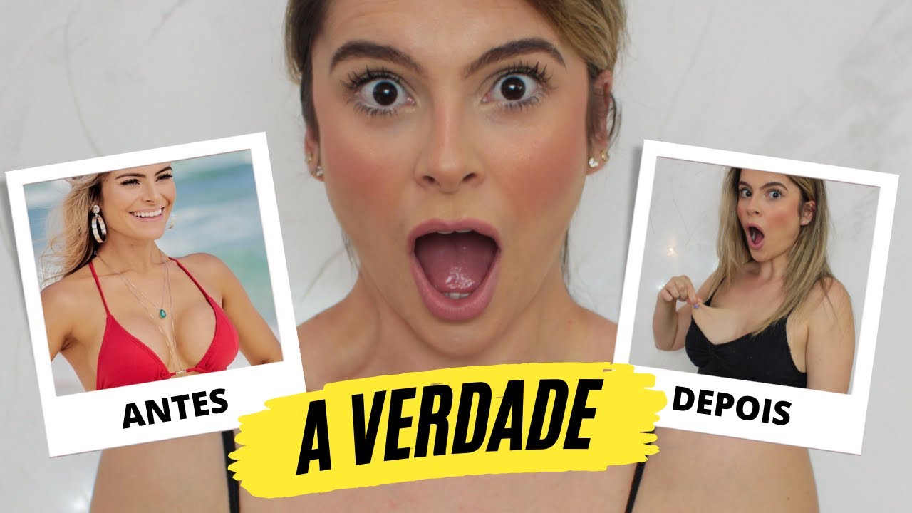 Como ficou o meu SILICONE APÓS AMAMENTAR 1 ANO