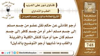 صورة 9227 - حكم نقل عضو من جسم مسلم إلى جسم مسلم آخر أو من جسم كافر إلى جسم مسلم كان حيا أو ميتا